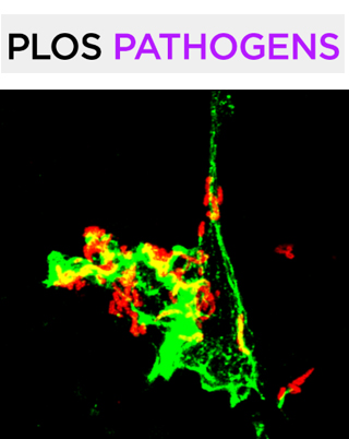 Cover of PLOS Pathogens, featuring study using the protocol.