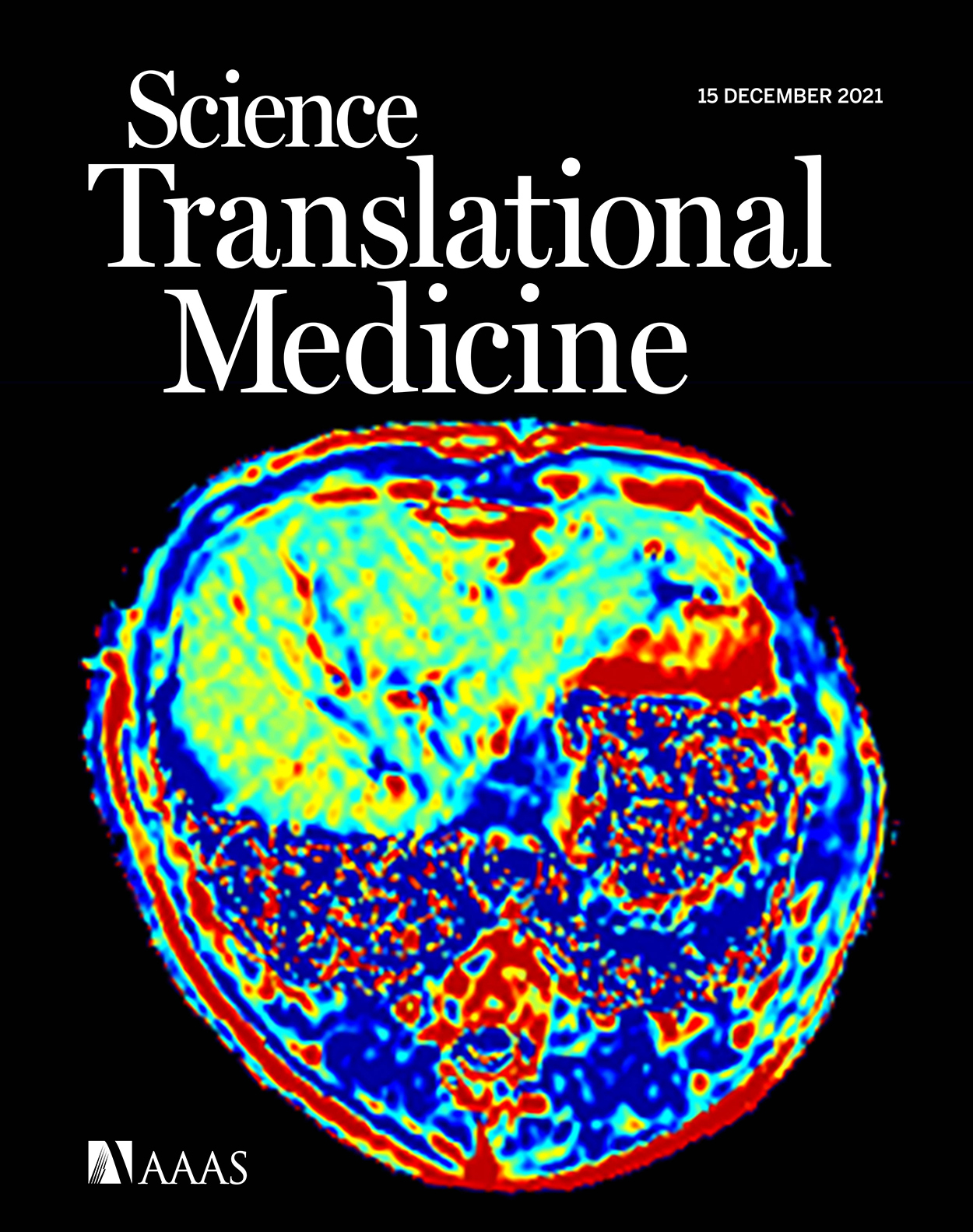 Cover of Science Translational Medicine, featuring study using the protocol.